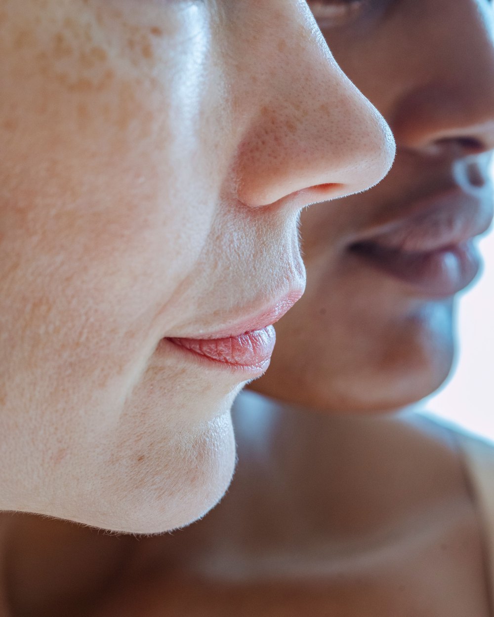 Flacidez y pérdida de definición facial